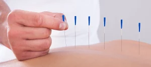 Acupuncture for substance abuse recovery